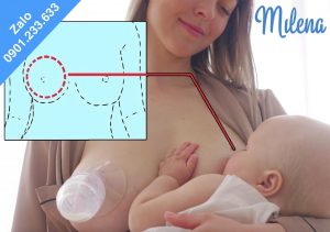 Ngực bên to bên nhỏ khi cho con bú - Milena