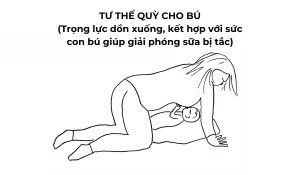 thông tắc tia sữa bằng lược
