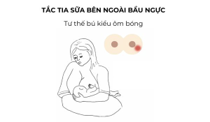 Kỹ Thuật Cho Con Bú Hiệu Quả Giúp Thông Tắc Tia Sữa-3